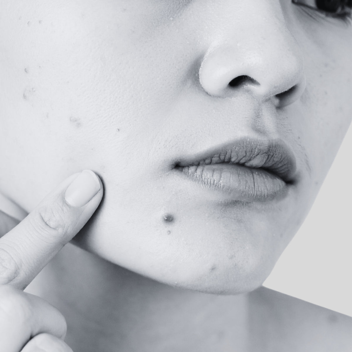 VECTR™ CORRECTIVE PEEL 50MLS