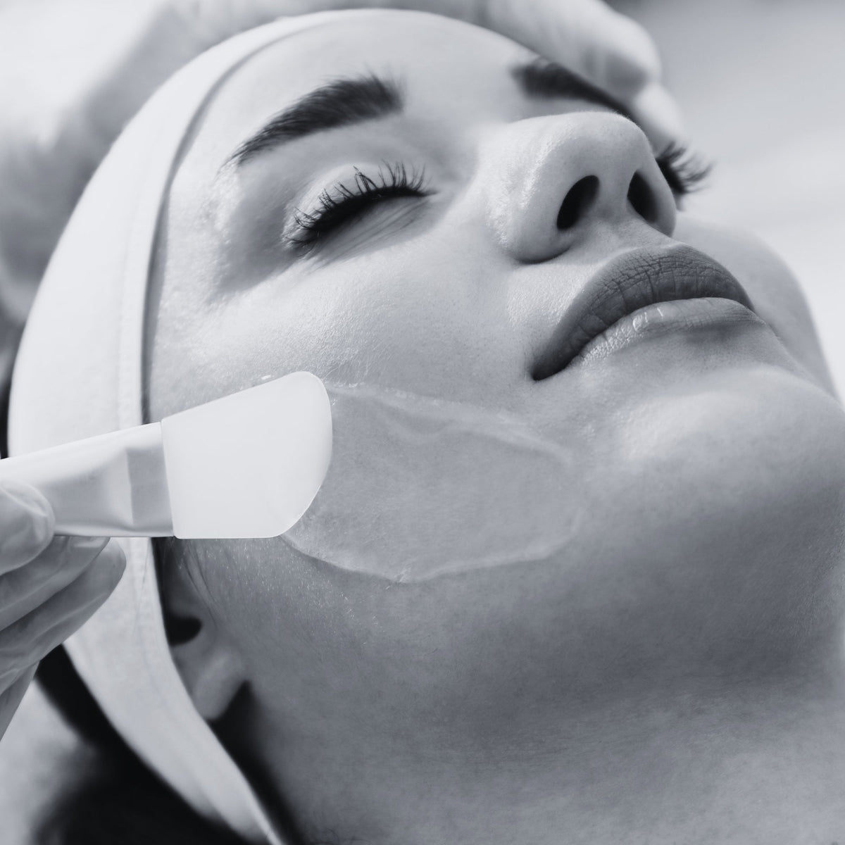 2. PROFESSIONAL - CHEMICAL PEELS
